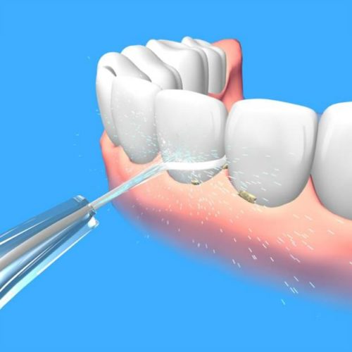  Presión del agua en los dientes.