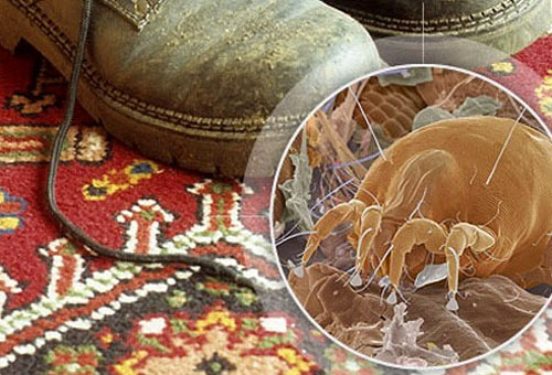  Microbios y zapatos