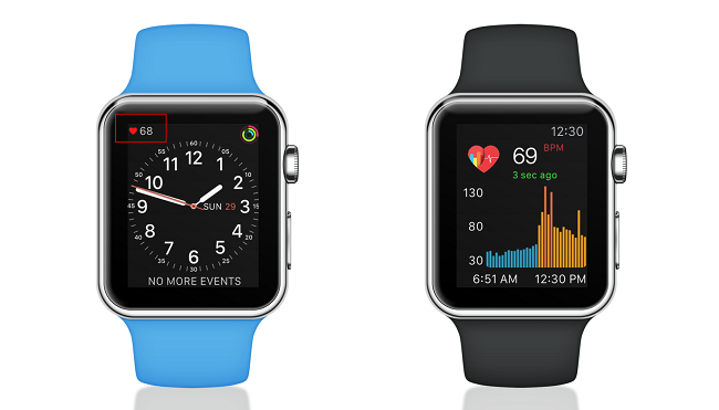  Cardiograma